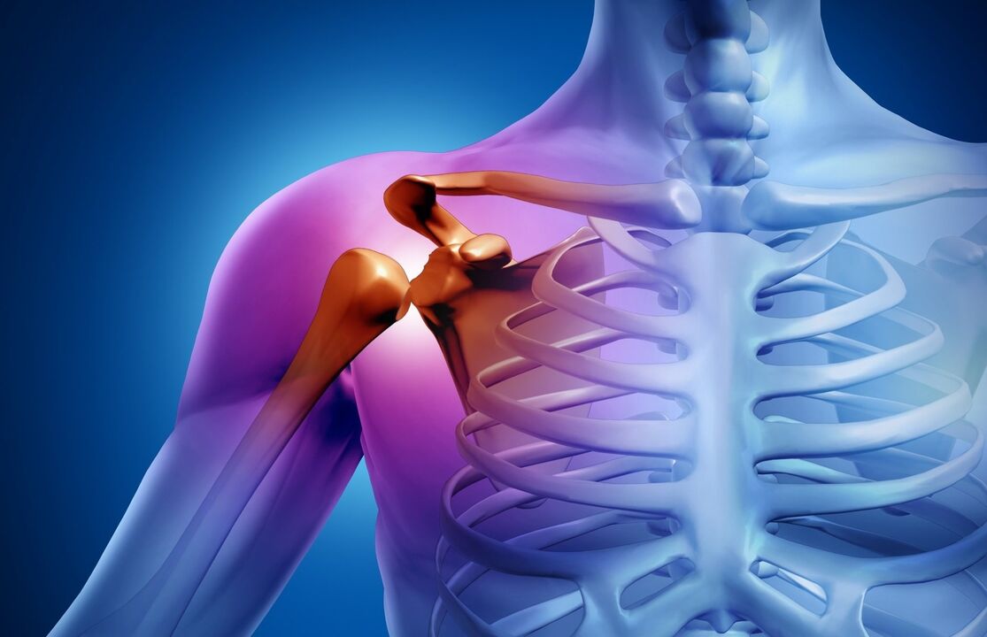 shoulder arthropathy