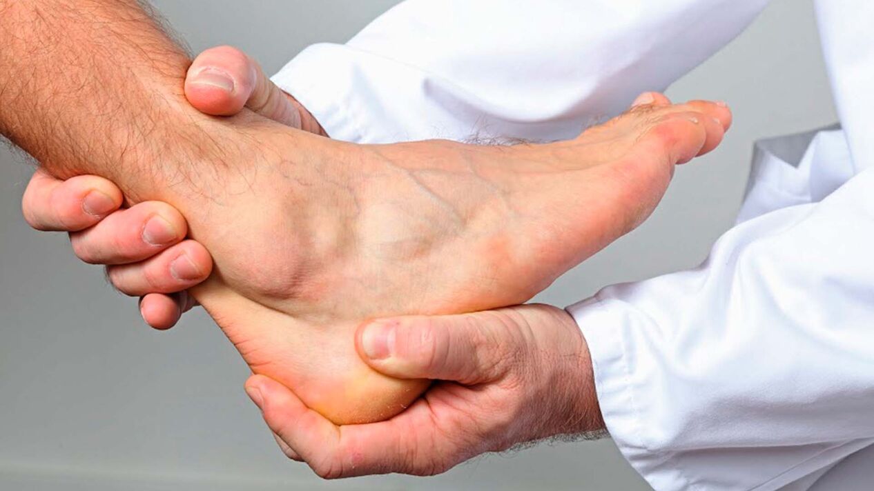 arthropathy of the ankle joint
