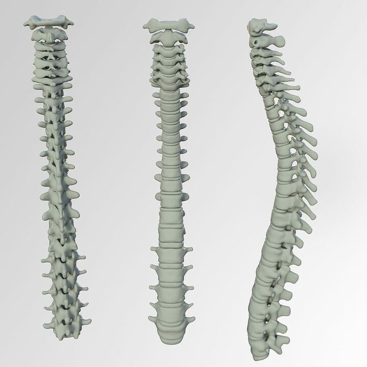 Spine shape