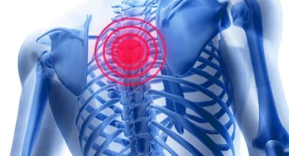 Treatment of osteochondicism of thoracic spine