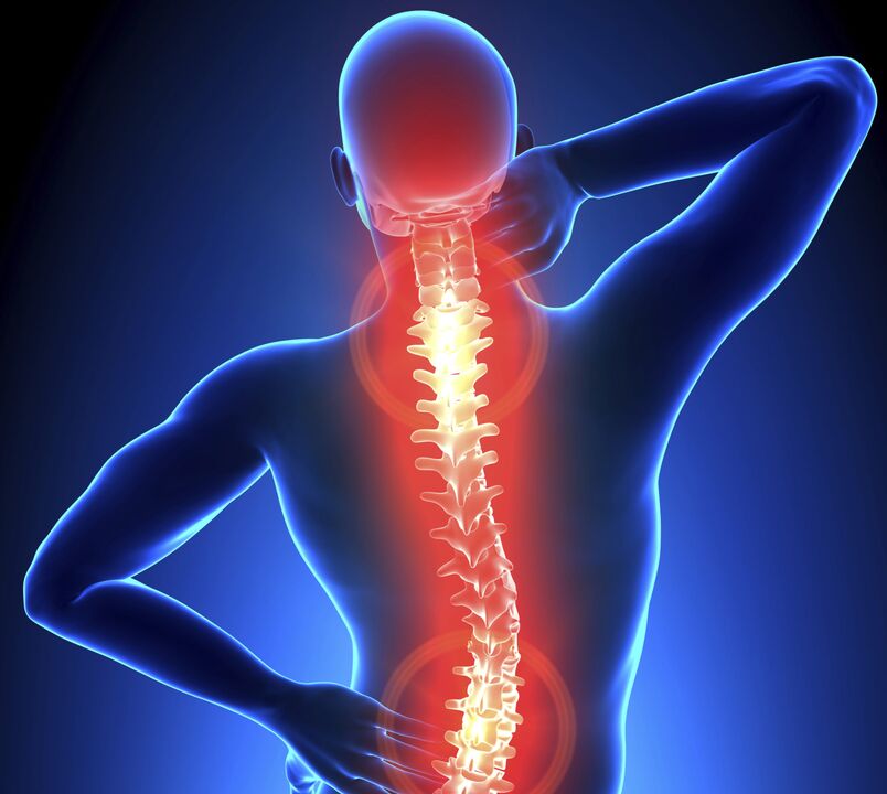 Osteochondria of the spine