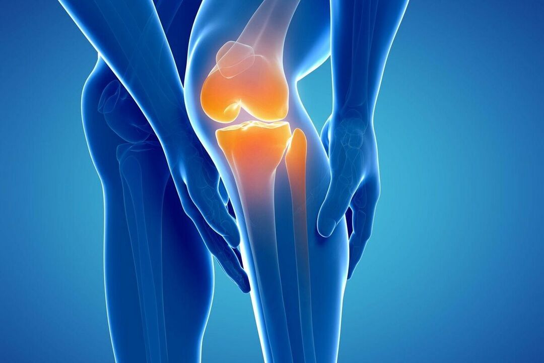 What is arthritis