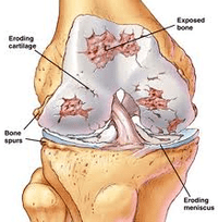 The mechanism for the development of the articulation